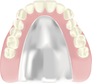 コバルトクロム床義歯
